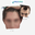 Hair Transplant Leeds
