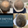 Wimpole Hair Transplant Clinic Newcastle